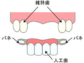 ブリッジや部分入れ歯の場合